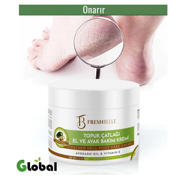 FreshBelle – كريم العناية المرطّب للقدم، الكعب، التشققات، الفطريات، الرائحة، والجروح السكرية